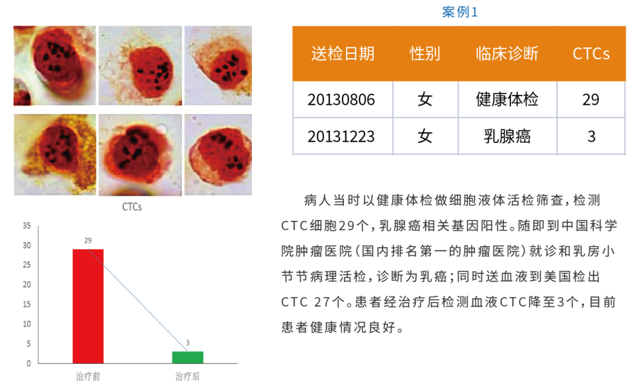 案例一.png