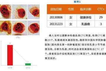 案例详情分享